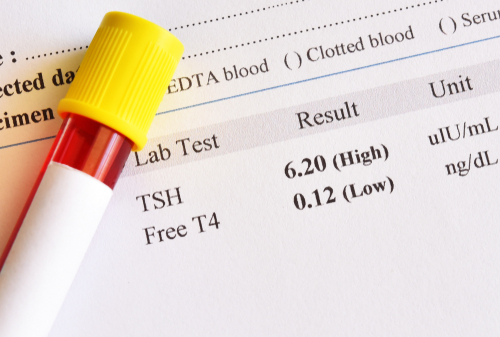 Bmr Calculator For Weight Loss - Understanding Your Basal Metabolic Rate