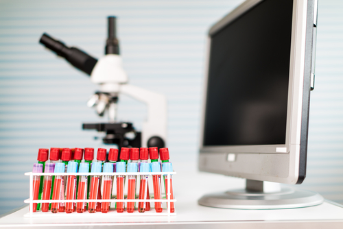 Top Facts About Metabolic Testing: How to Prepare? Top Facts About Metabolic Testing: How to Prepare?